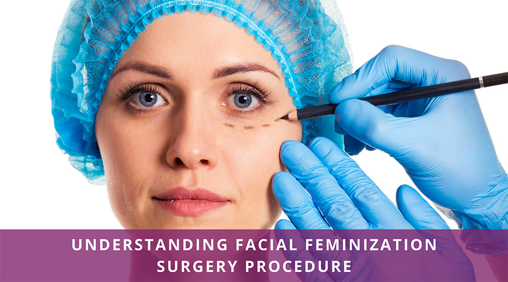 Facial Feminization Surgery